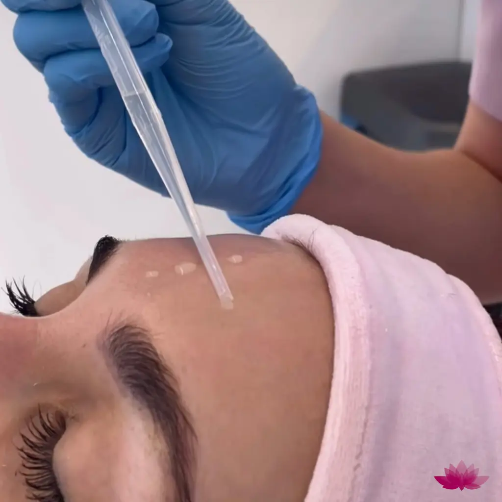 Peeling kwasowy Retix C i jego neutralizacja