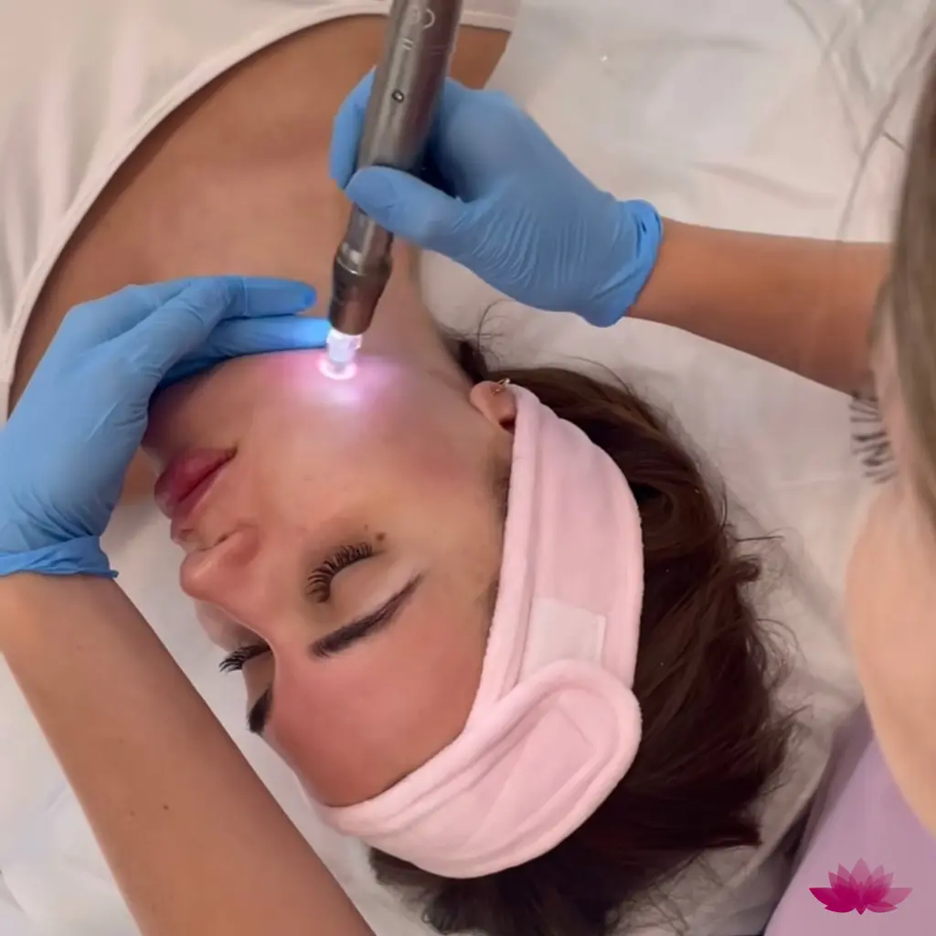 Mezoterapia przy Retix C Smart DNA