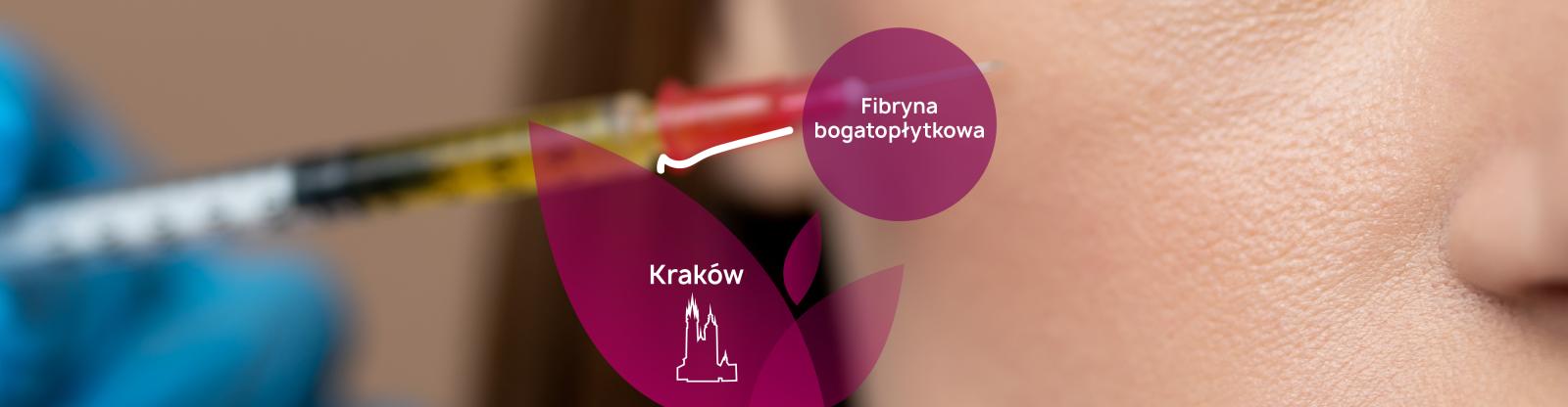 Co daje fibryna bogatopłytkowa Kraków? - PerfectLift