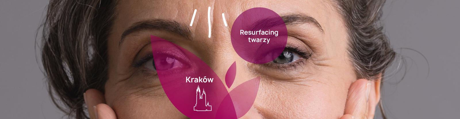 Gdzie i w jakiej cenie zrobić resurfacing laserowy Kraków? - PerfectLift