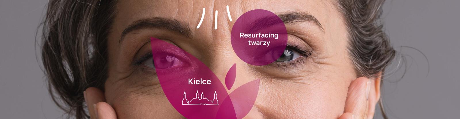 Ile kosztuje resurfacing skóry Kielce i jakie przynosi korzyści? - PerfectLift