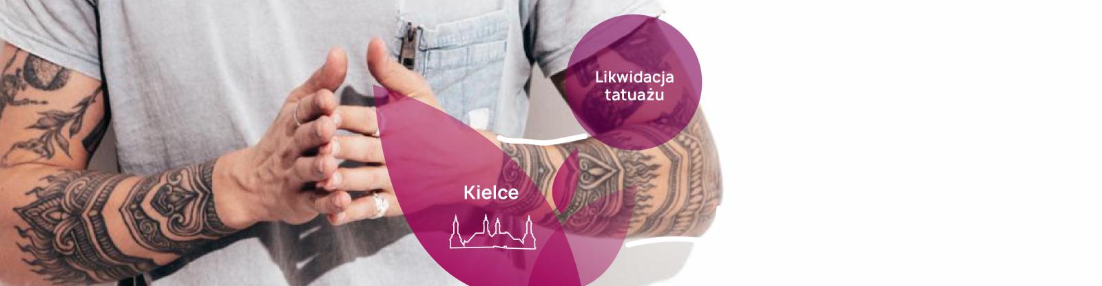 Jak wygląda usuwanie tatuażu Kielce oraz cennik PerfectLift? - PerfectLift