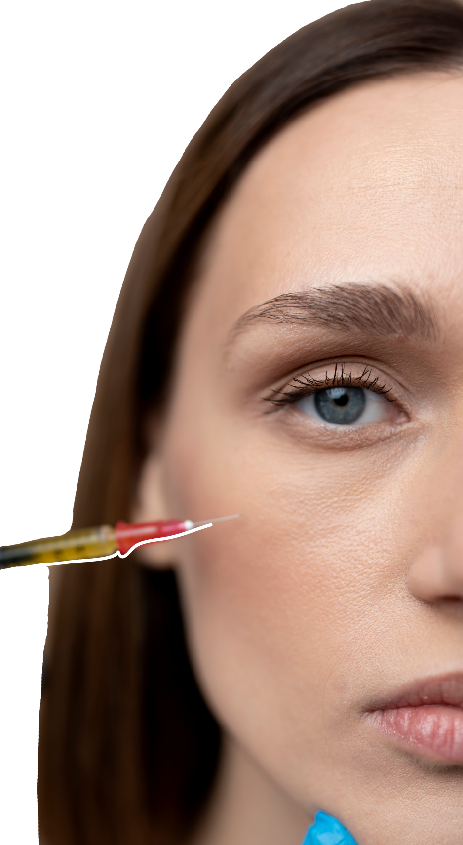 Pacjentka po zabiegu medycyny estetycznej - ostrzykiwanie fibryną w Krakowie