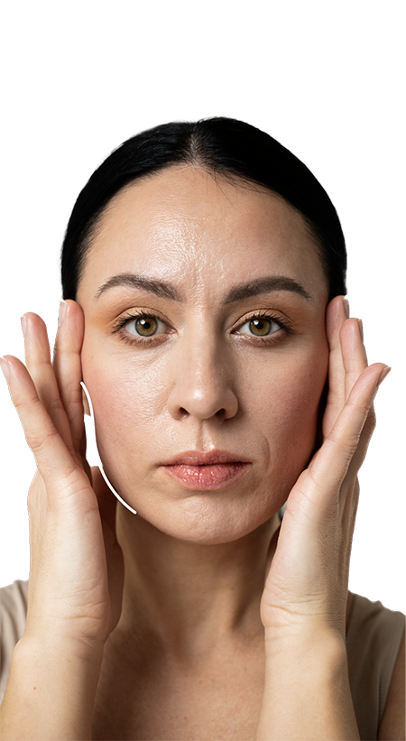 kobieta po szczepieniu. fotoodmładzanie laserem