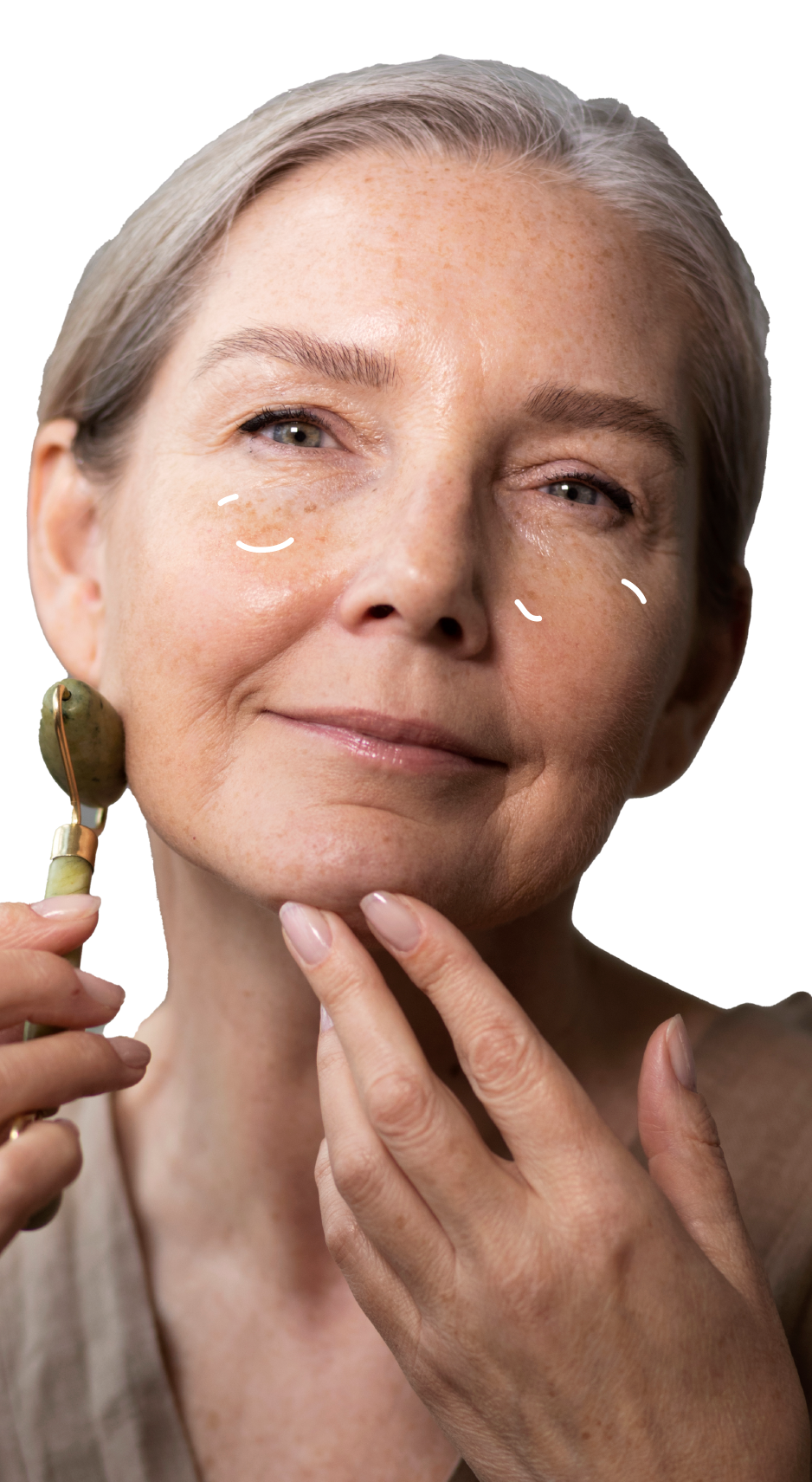 Pacjentka po zabiegu medycyny estetycznej - usuwanie przebarwień na twarzy Kraków