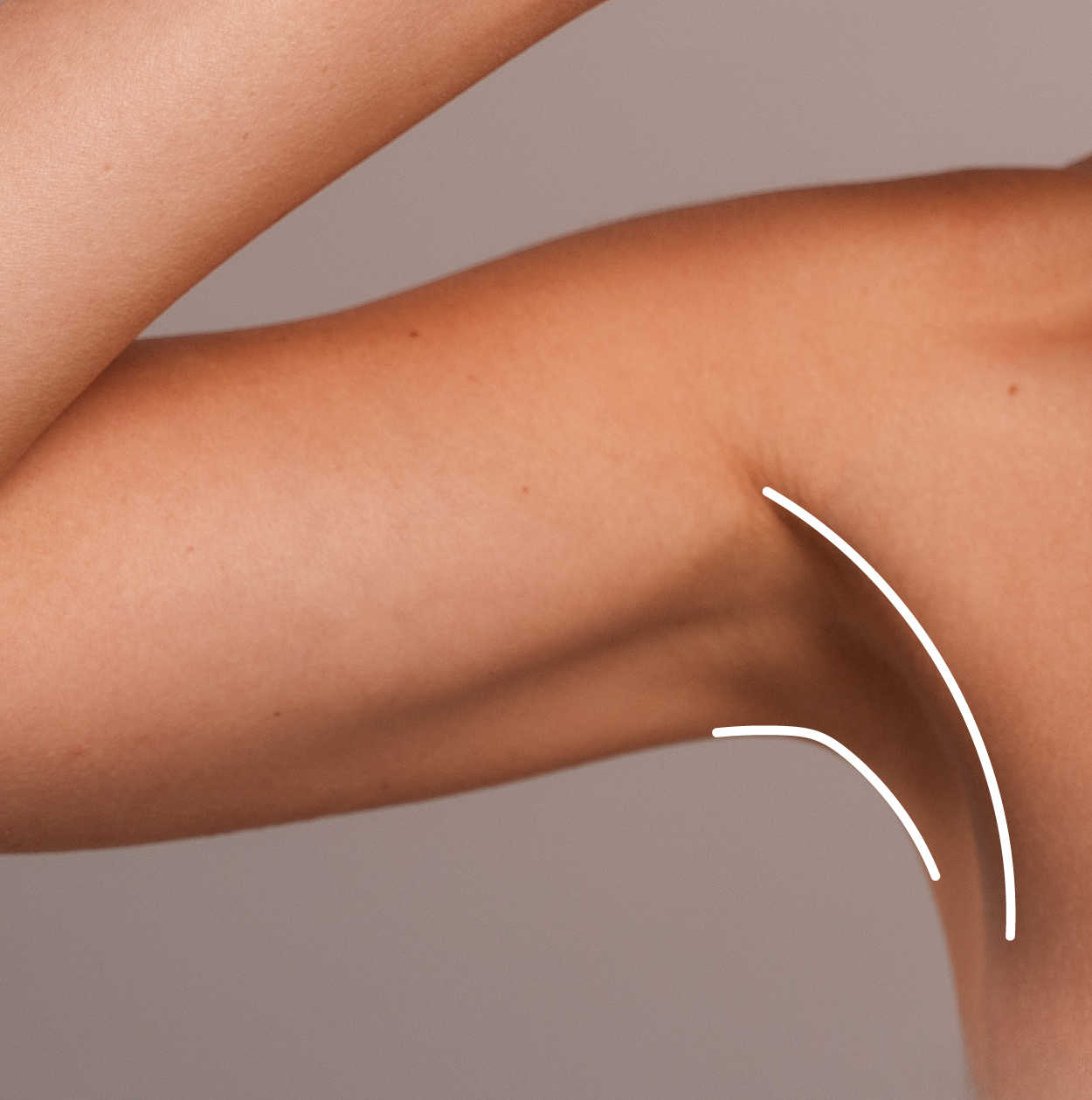 Leczenie nadpotliwości  - zdjęcie