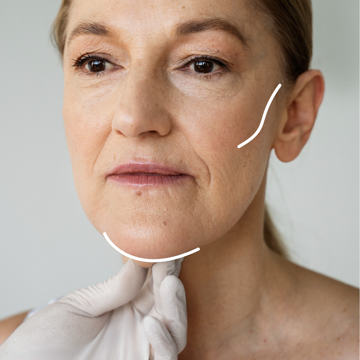 Wolumetria twarzy - zdjęcie